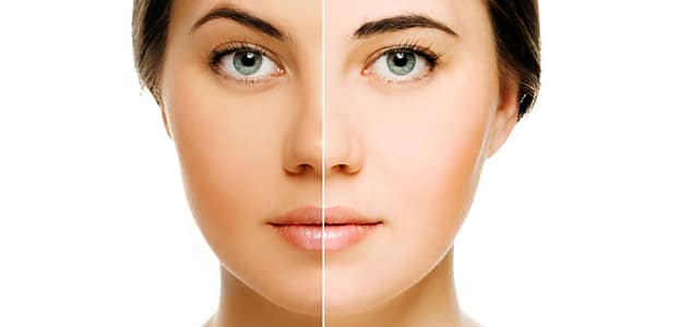 treatments for sun damage