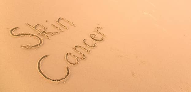 Can you prevent skin cancer with laser treatments