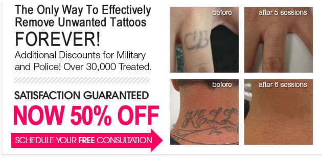 the hardest tattoo u0027s to remove laseraway the hardest tattoo u0027s to remove laseraway
