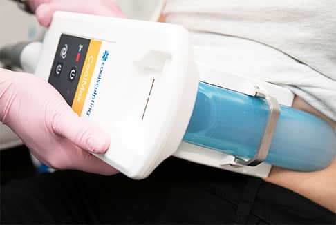 Cool Sculpting on Women's Belly Fat