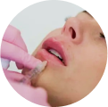 Dermal Fillers