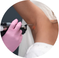 Laser Hair Removal