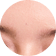 Frown Lines treatment area