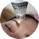 Potenza™ RF Microneedling treatment area