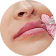 Cupid’s Bow Enhancement treatment area