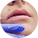 Hydrating Lip Filler treatment area