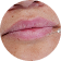 Correct Asymmetry treatment area