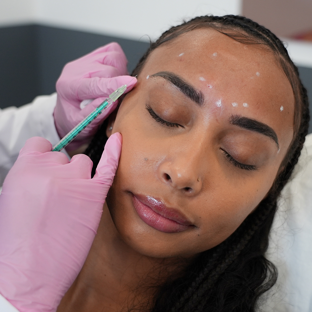 Remove Facial Wrinkles Quickly: Top Treatments