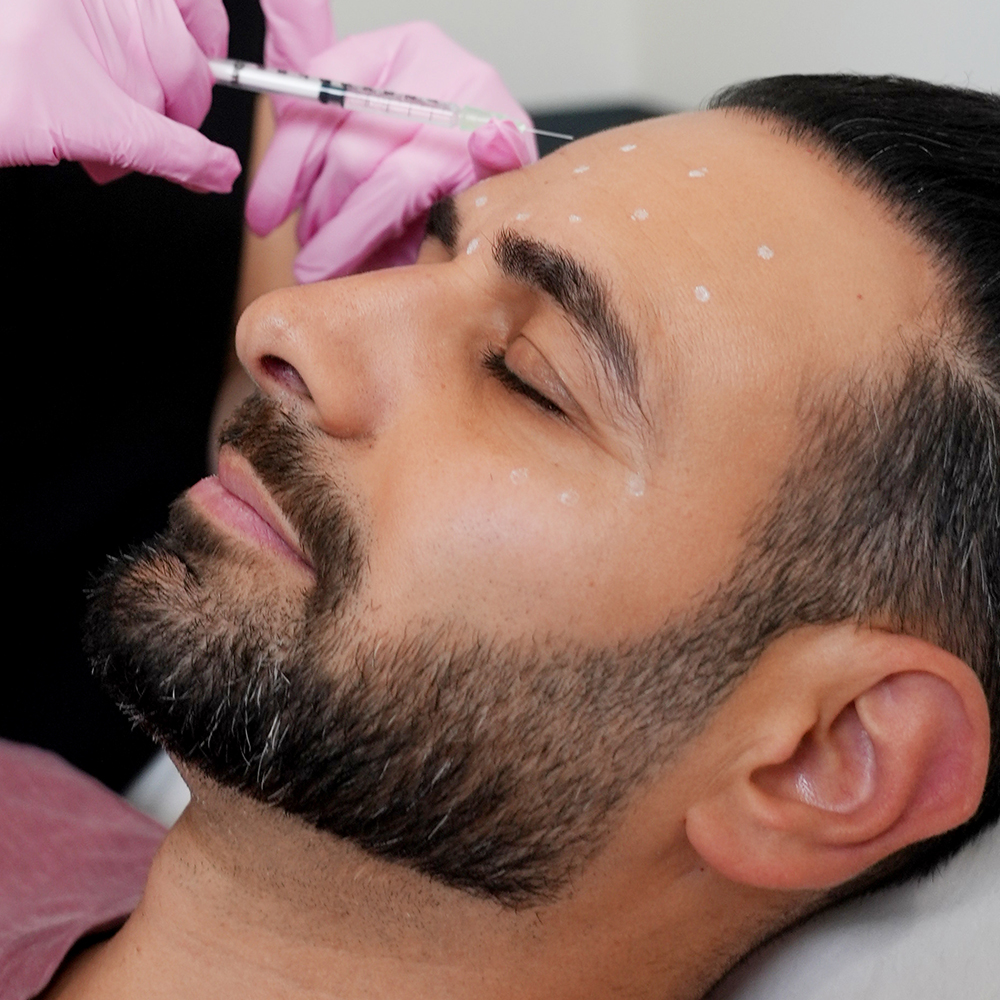 Botox Day What Is It And What To Expect