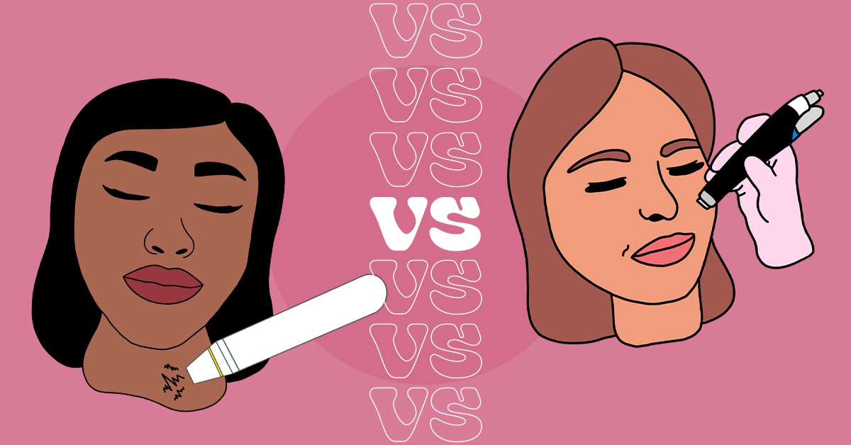 RF Microneedling vs Laser Facial Life by LaserAway