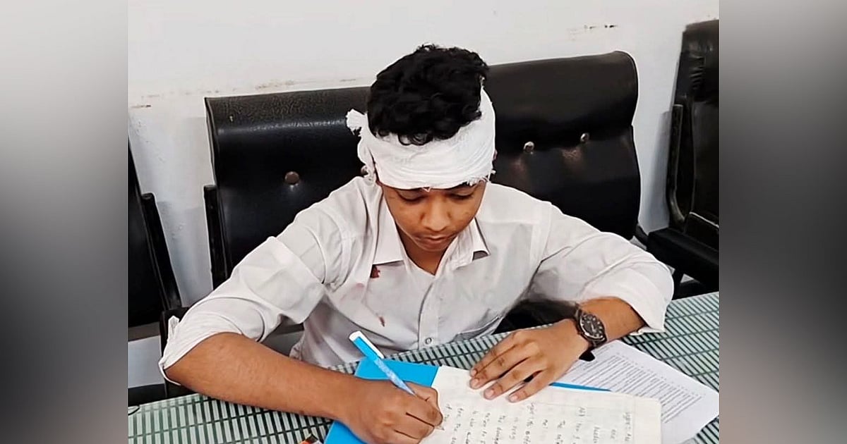 এসএসসি পরীক্ষার্থীর ওপর পাখা খুলে পড়ল, ব্যান্ডেজ মাথায় শেষ করল পরীক্ষা