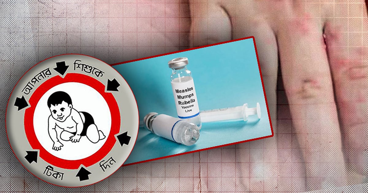 বাচ্চাদের টিকা দিতে অনিচ্ছুক অভিভাবকদের সচেতনতা তৈরির পরামর্শ