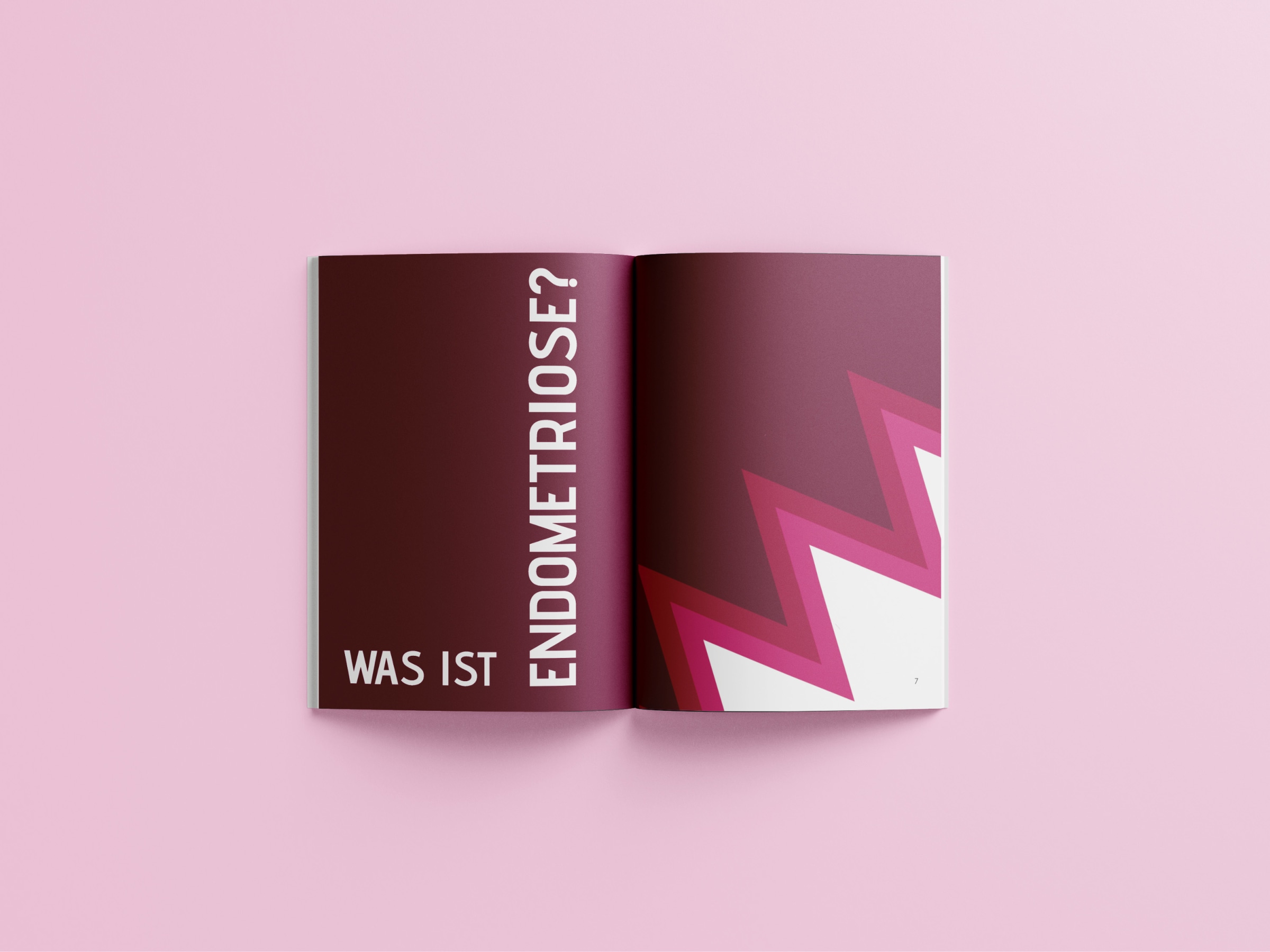 Endometriose: Verstehen & Erkennen