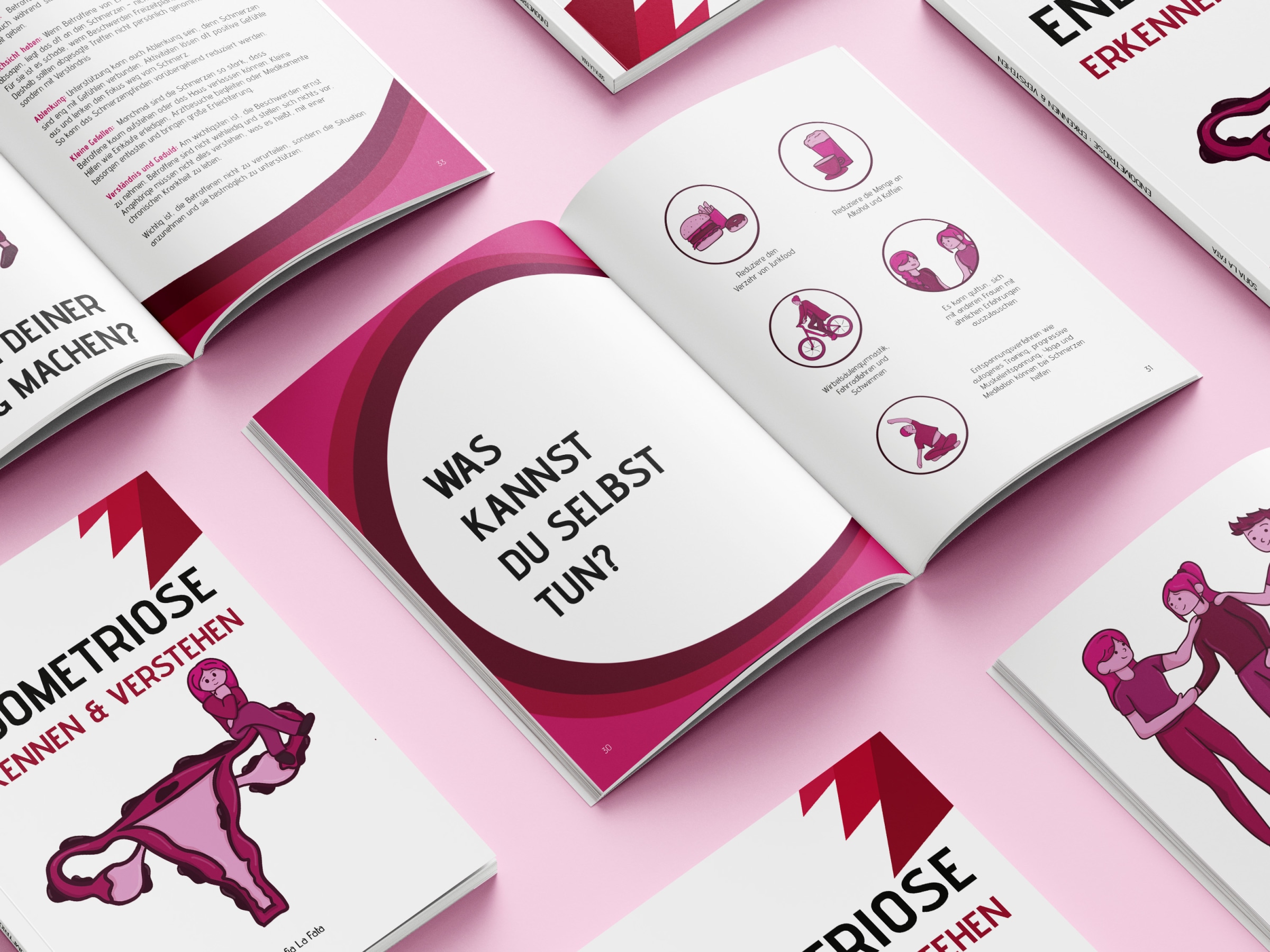 Endometriose: Verstehen & Erkennen