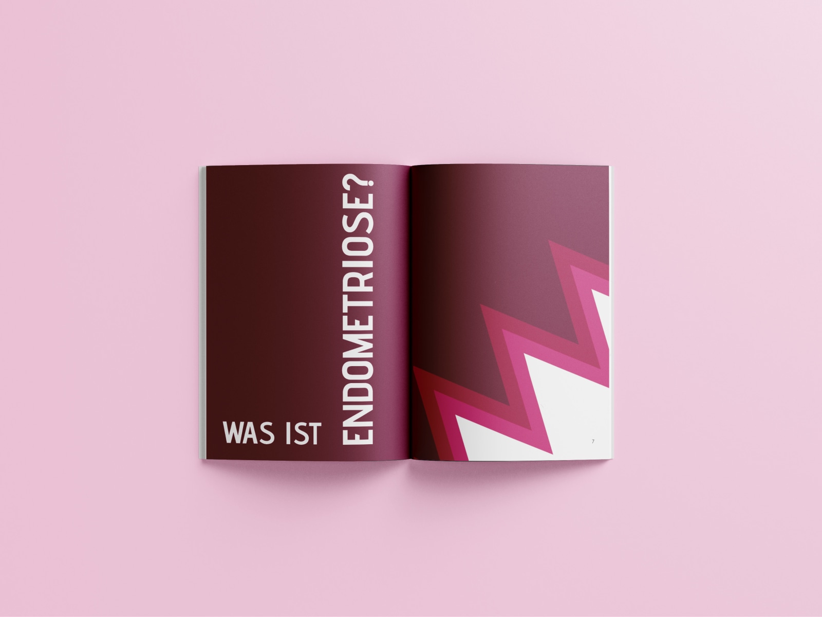 Endometriose: Verstehen & Erkennen