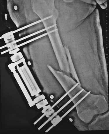 Orthofix medical device SEC secures admission from Orthofix after repeat FCPA violations