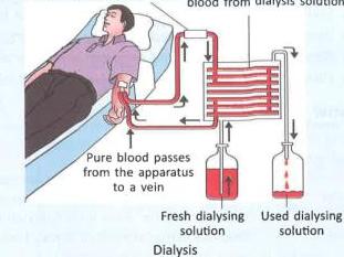 06._Excretory_System_img_10
