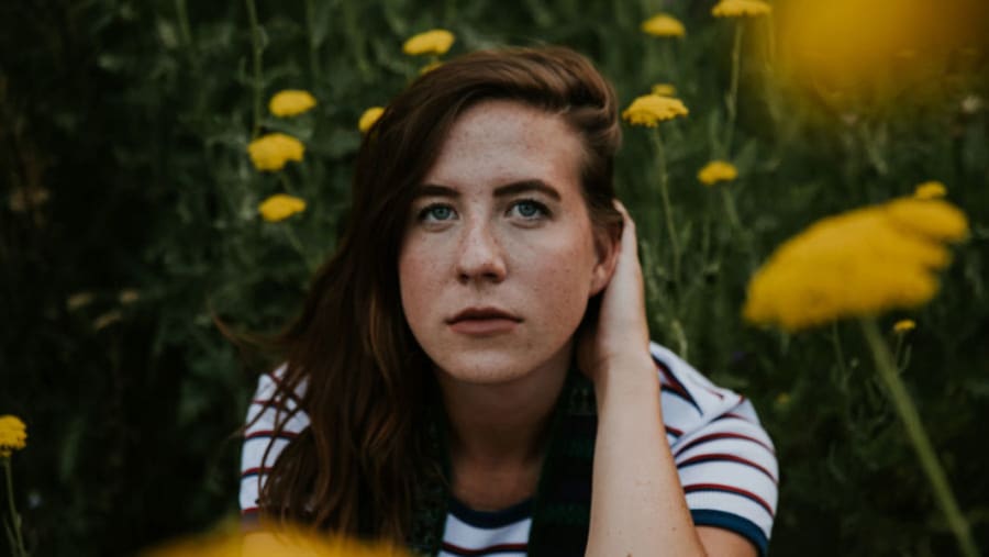 Girl with acne who is using acupuncture as a treatment