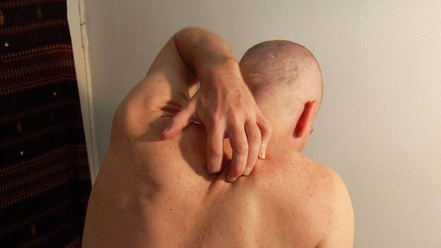 man scratching guttate psoriasis on back