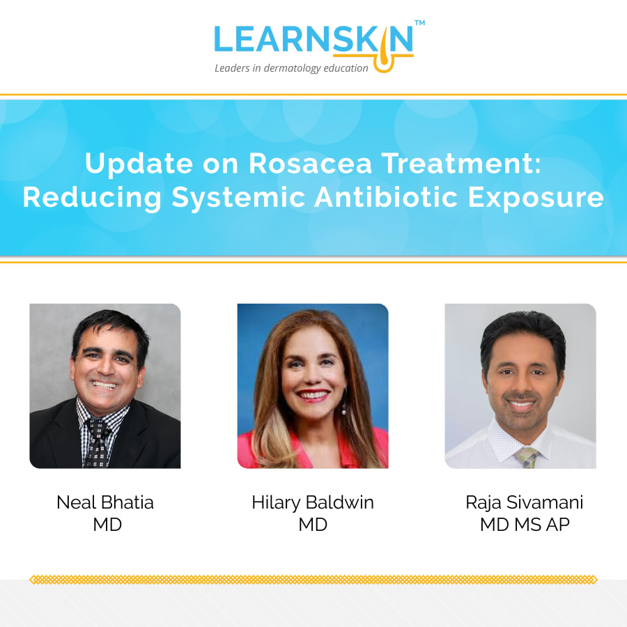 Update on Rosacea Treatment: Reducing Systemic Antibiotic Exposure