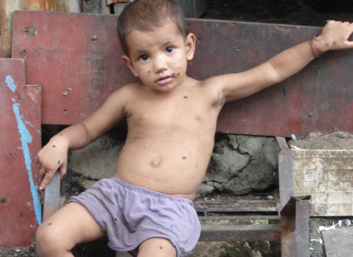 Get Impact - Support Apnalaya