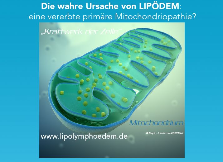 Die wahre Ursache von LIPÖDEM, eine weitgehend unbekannte Volkskrankheit bei Frauen