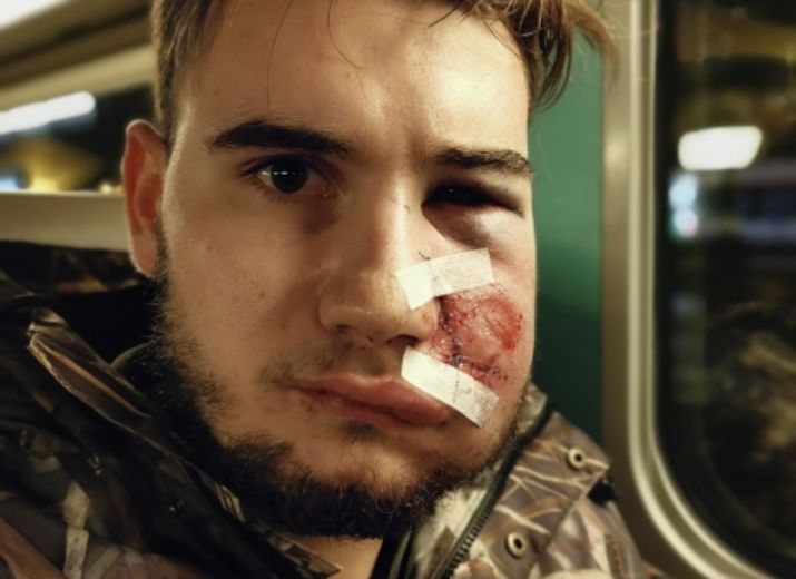 Aidons Thomas victime d'un tir de flashball gratuit durant une manifestation à PARIS le 8 Décembre 2018