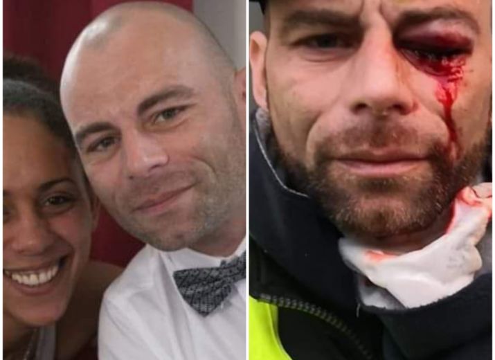 Cagnotte pour Jérôme citoyen qui a voulu nous défendre à Paris et se retrouve avec un oeil perdu aidons le à subvenir aux nombreux soins qu'il va subir #gilets jaunes