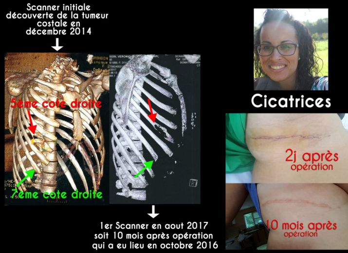 EXPERTISE JUDICIAIRE : POUR RENDRE JUSTICE A MA SŒUR VÉRONIQUE