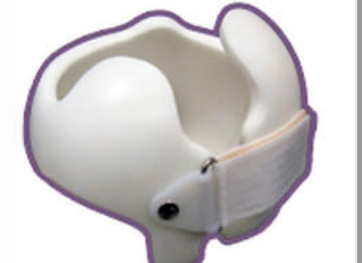 Cagnotte Une Orthese Cranienne Pour Mon Bebe Leetchi Com