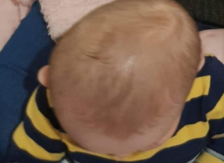 Cagnotte Une Bouille Pour Noham Leetchi Com