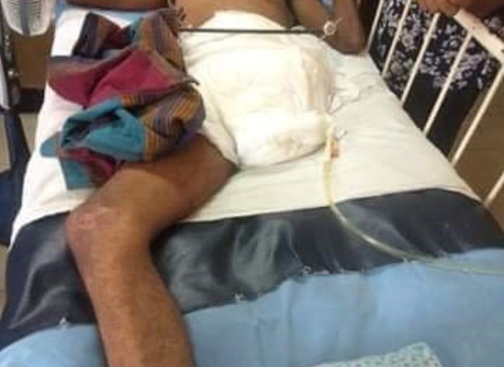A new leg and a new life to Priyantha!