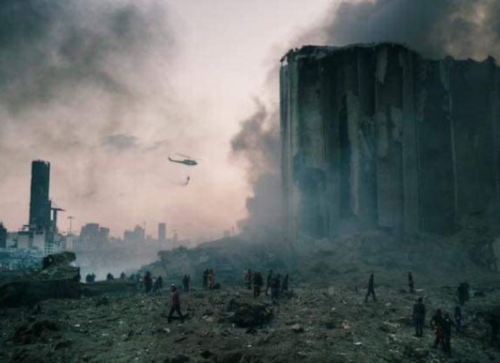 Lebanon is bleeding!