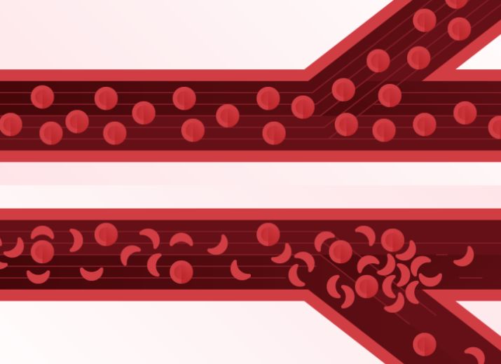 Sickle Cell Disease Association of America