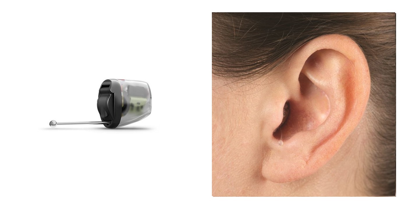 In the Canal hearing aid device and in ear