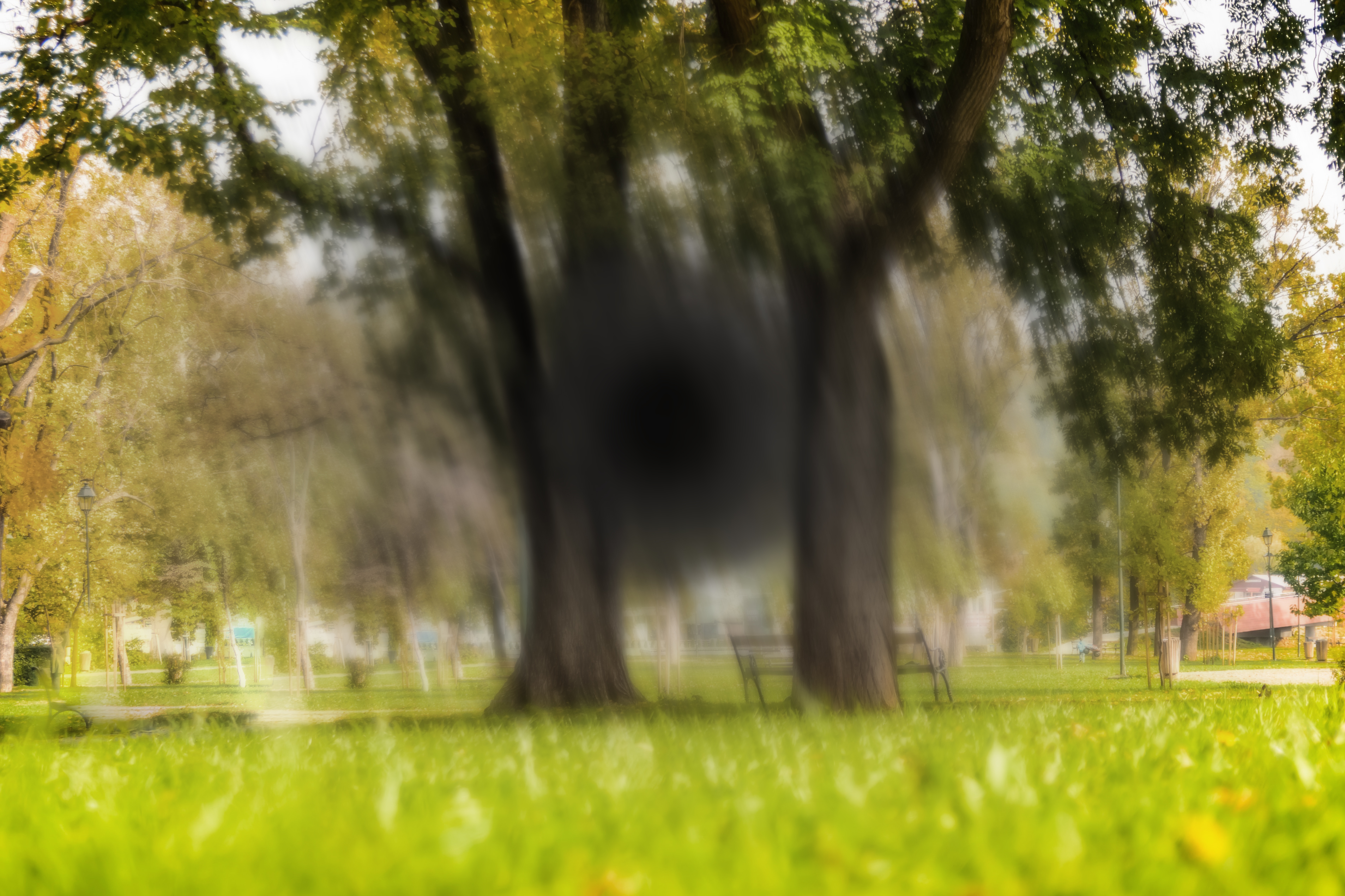 macular degeneration