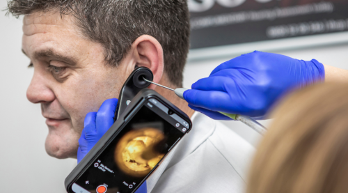 ﻿A wax removal clinician removing wax from a patient's ear.