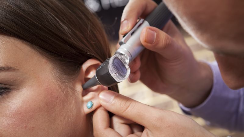 The causes of sudden hearing loss