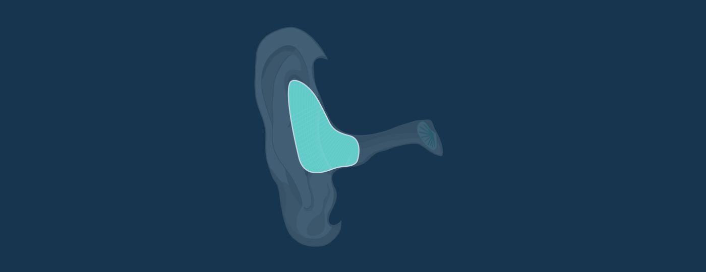 In The Ear (ITE) Full Shell Hearing Aids