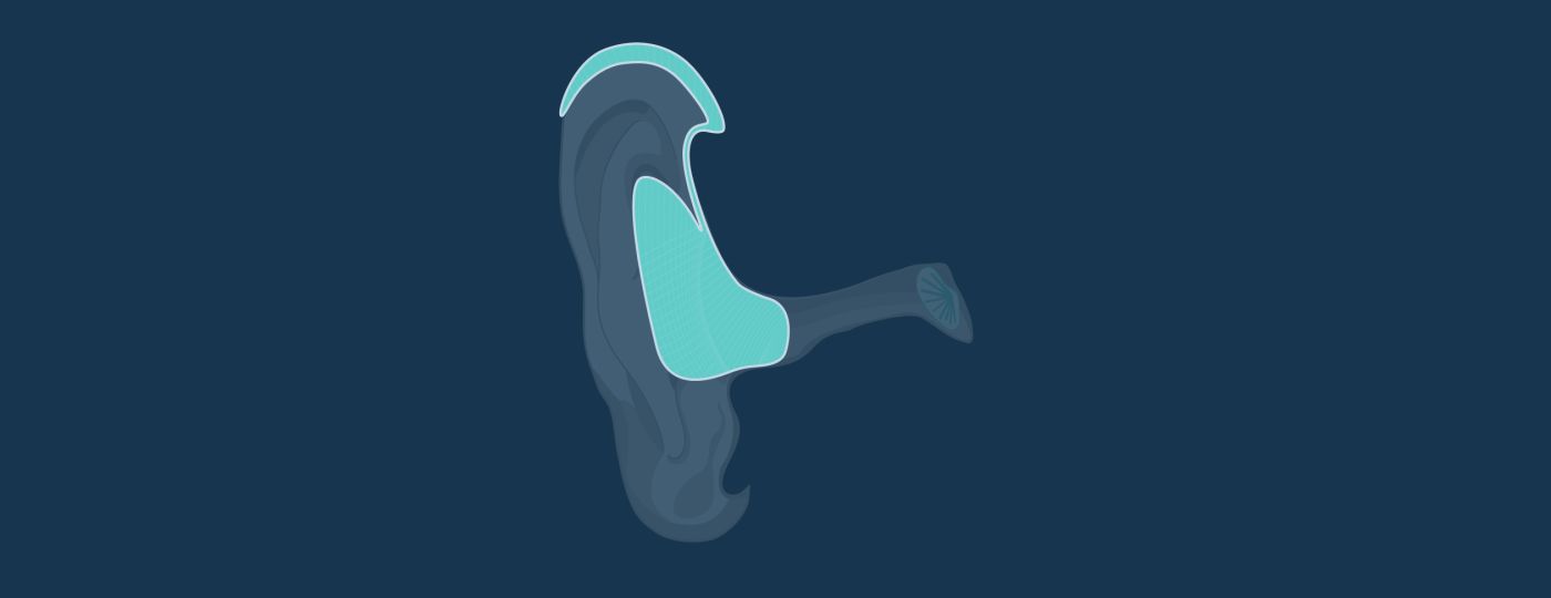 Behind The Ear (BTE) Hearing Aids