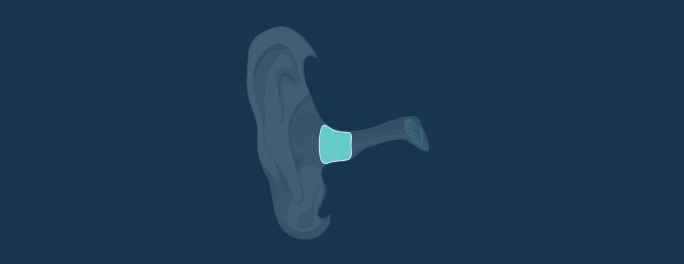 Completely In Canal (CIC) Hearing Aids