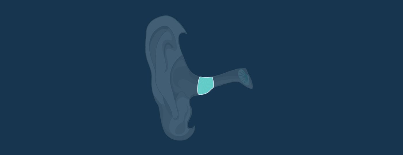 Invisible In Canal (IIC) Hearing Aids