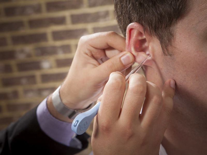 Man extracting wax out of patients ear