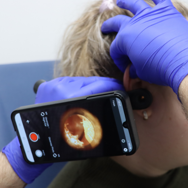 A hearing clinician examining the ear of a patient with a Tympa device