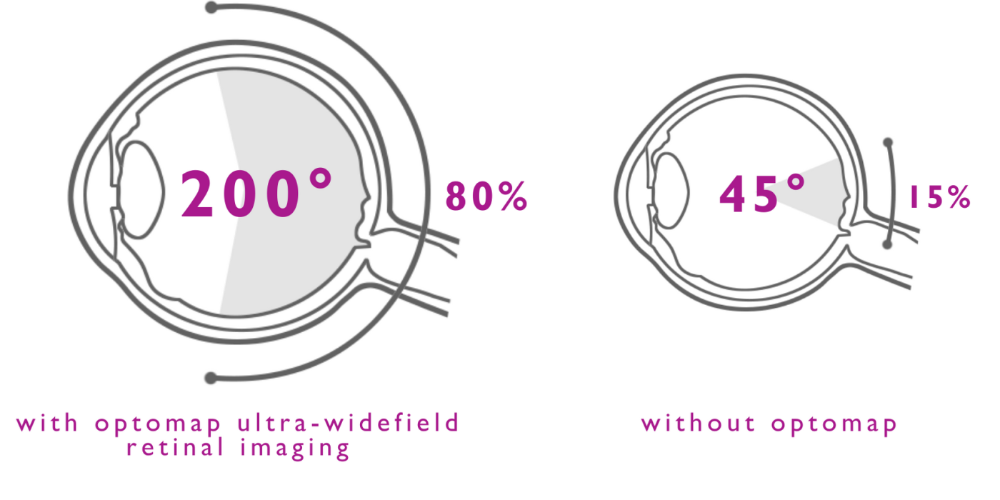 UUE Diagram