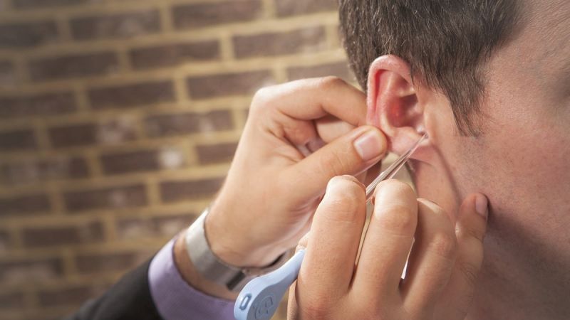 How To Remove Ear Wax
