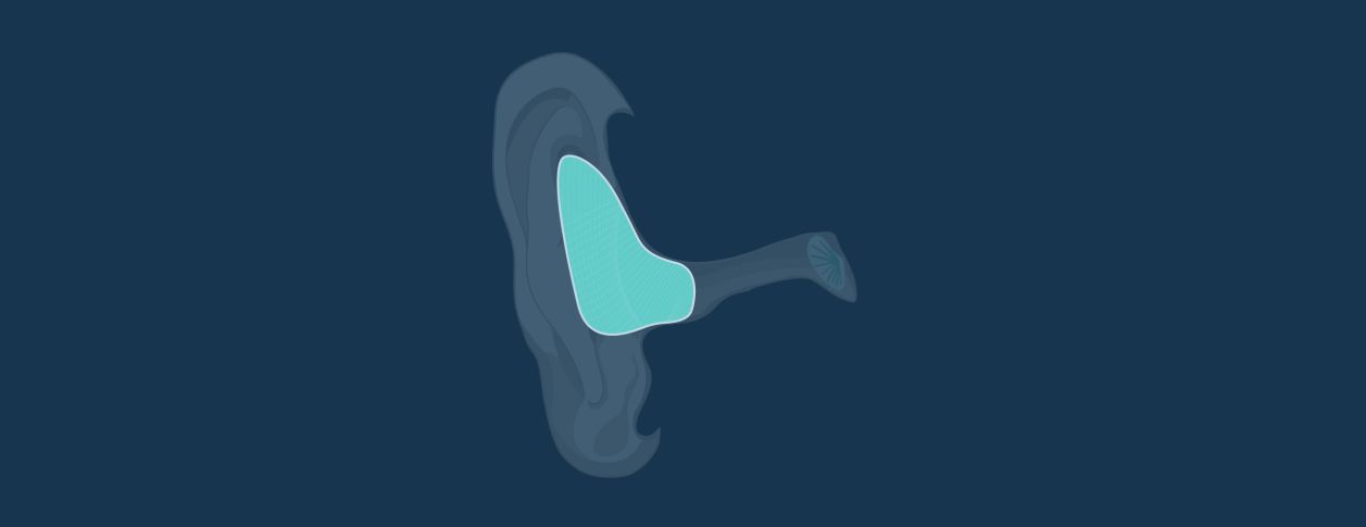 In The Ear (ITE) Full Shell Hearing Aids