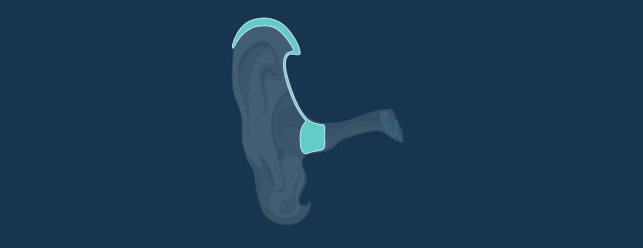 Receiver In Canal (RIC) Hearing Aids