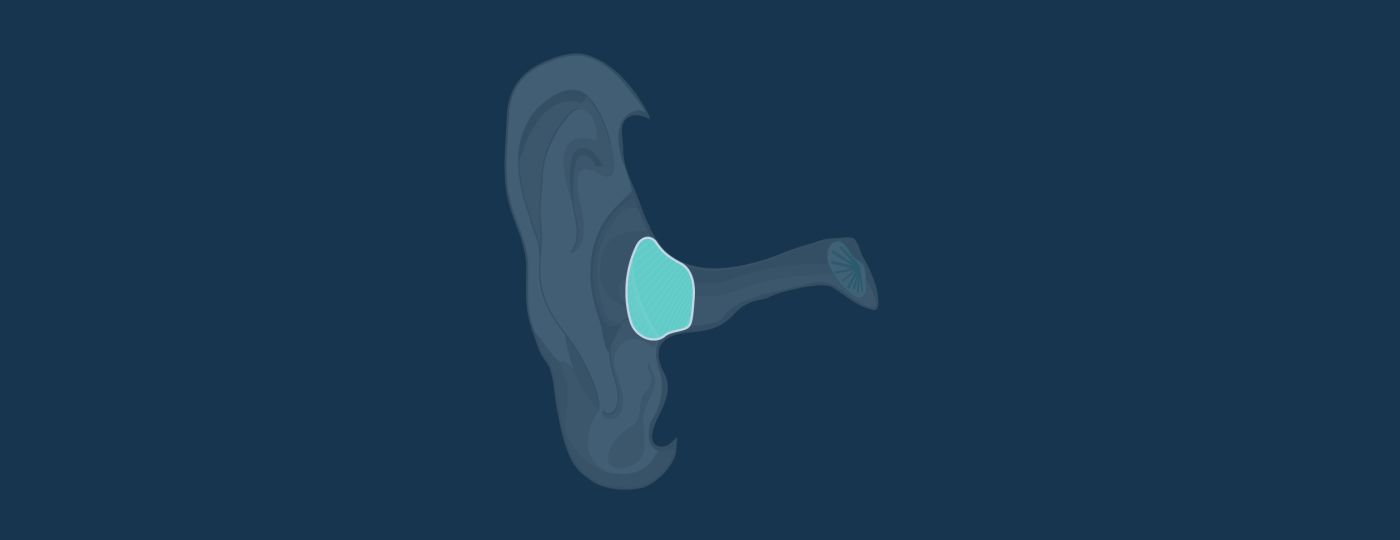 In The Canal (ITC) Half Shell Hearing Aids