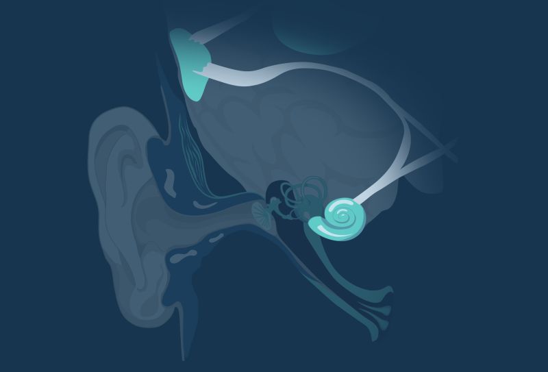 What causes tinnitus?